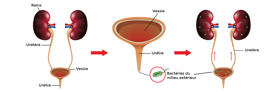 Cystite mecanisme