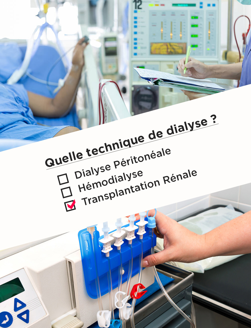 Dialyse péritonéale ou Hémodialyse