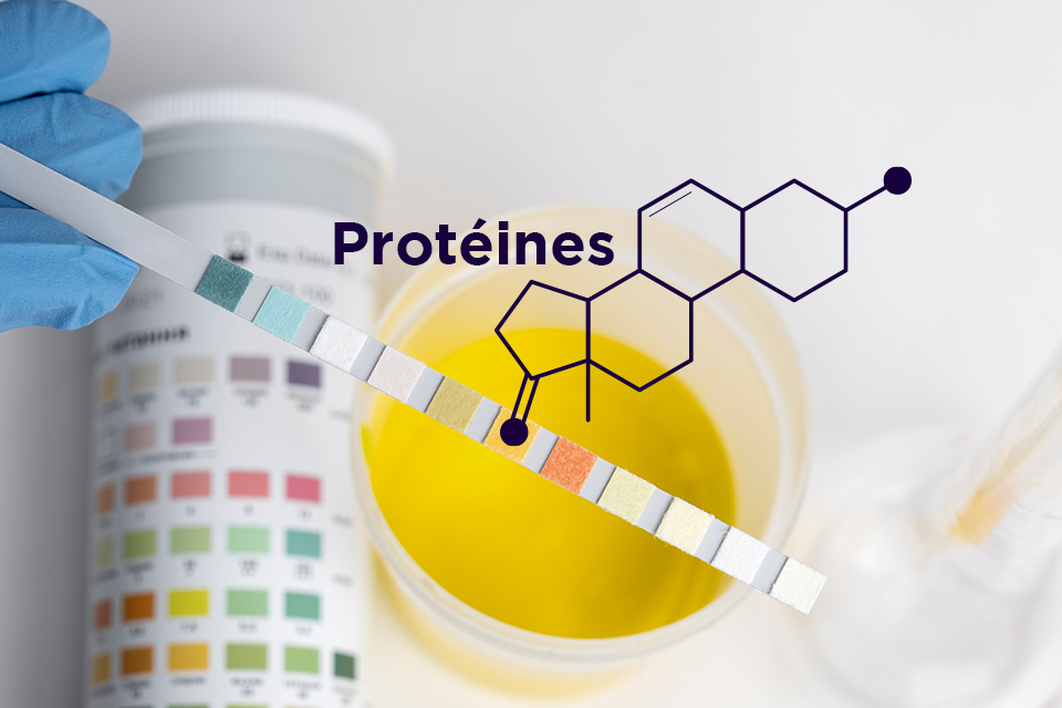 Les Maladies Rénales Chroniques de l’enfant