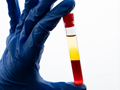 hematurie-infection-urinaire