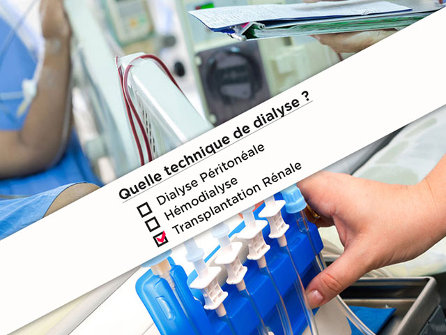 Post--Hémodialyse-ou-dialyse-péritonéale--02